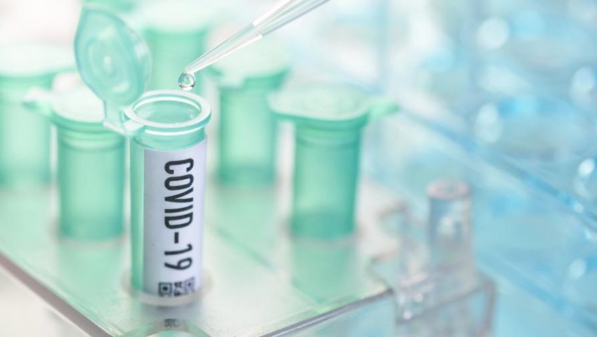 Драматичено спаднаха случаите на Covid-19 в България за последното денонощие