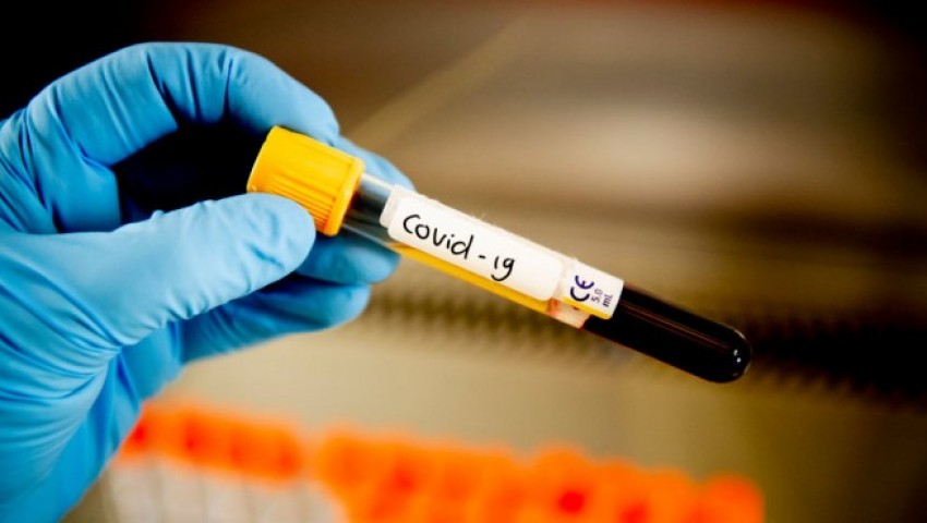 Нови 4 заразeни с Covid-19 във Варненска област за последното денонощие. В страната са 117