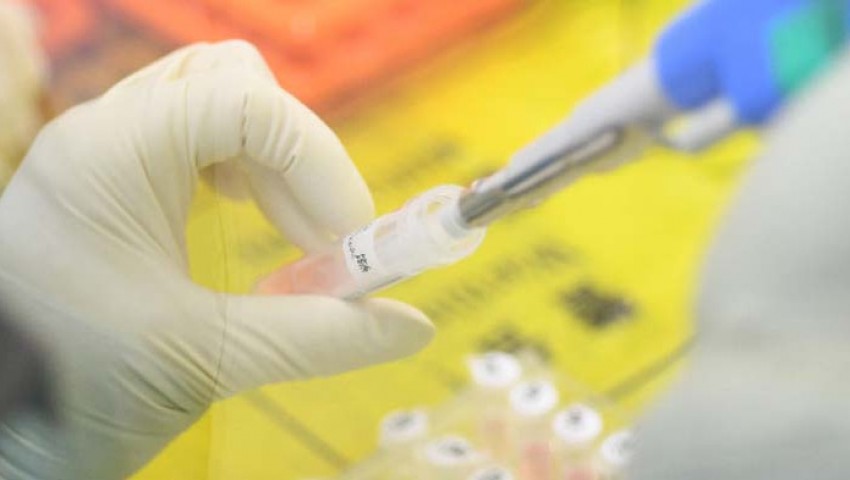 Затварят яслена група във Варна, заради положителна проба за COVID-19 на дете