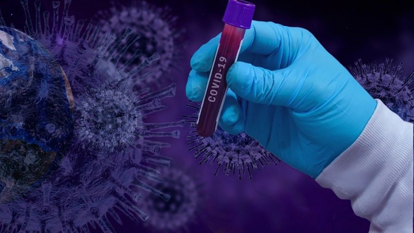 83 са новите случаи с COVID-19 у нас, има и 4 жертви
