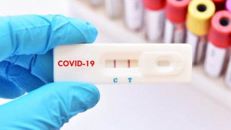 Изследват учители от Варненска област с бързи тестове за Covid 19