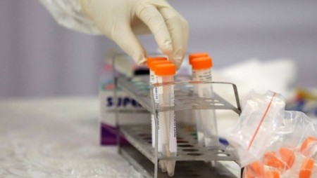 В Гърция: Първи смъртен случай на ваксиниран срещу COVID-19