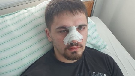 Има отстранени служители на МВР след побоя над младеж от Плевен